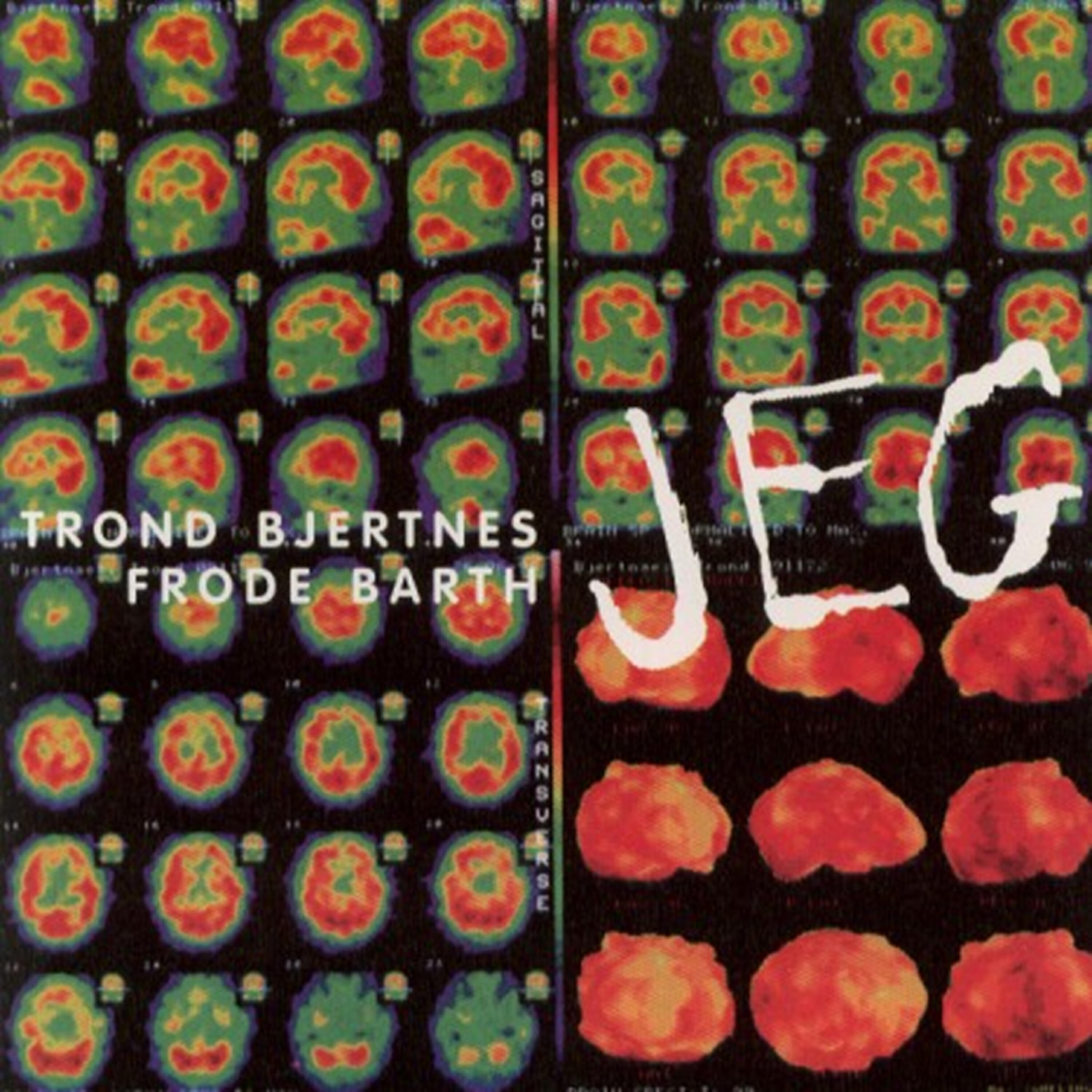 Trond Bjertnes - To Bein